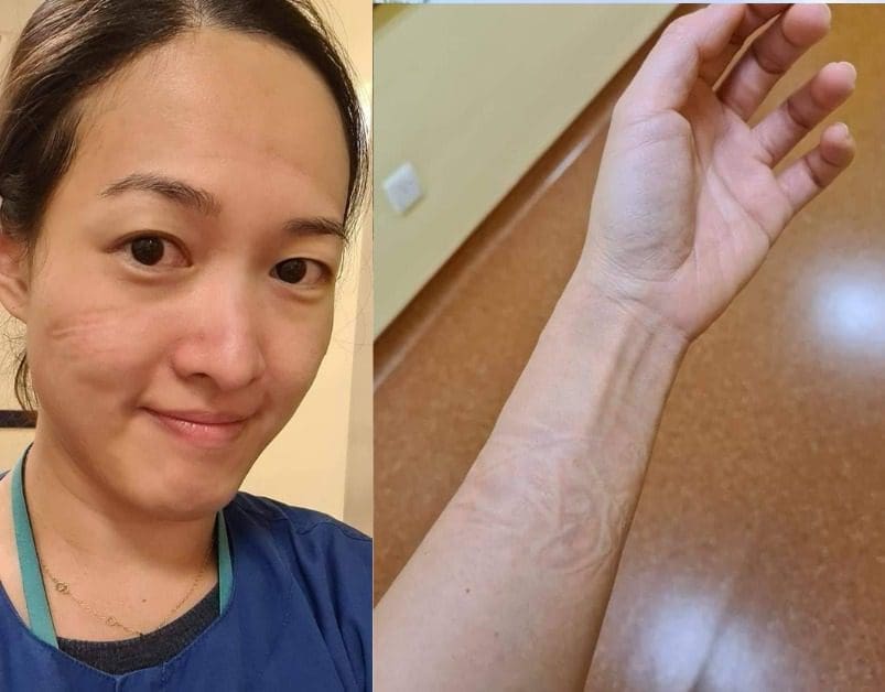 "Don't feel guilty if you are infected with Covid-19" says a Malaysian frontline doctor