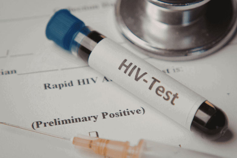 HIV test result