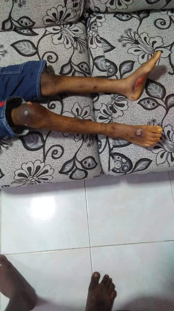 Iskandar puteri nanny abuse kids legs