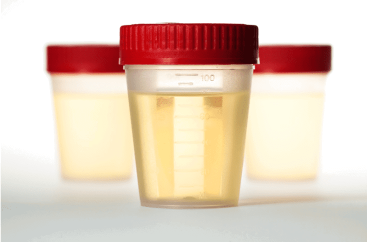 Bottle of urine sample
