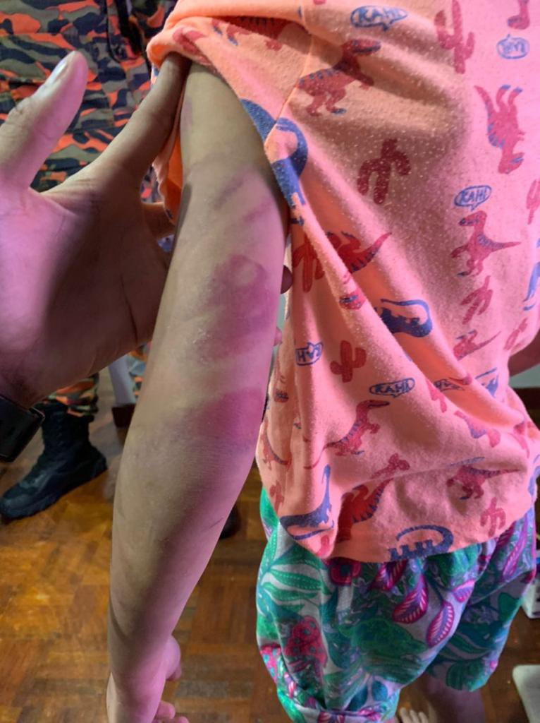 8yo Child Abuse Victim Rescued By Firefighters From The 4th Floor Of Ampang Apartment