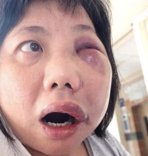 punched