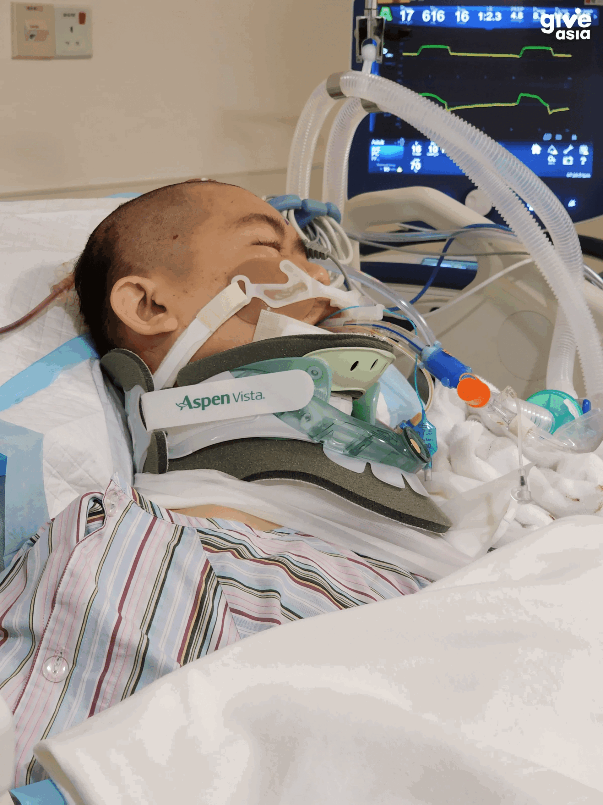 Ha Wee Chen in a coma