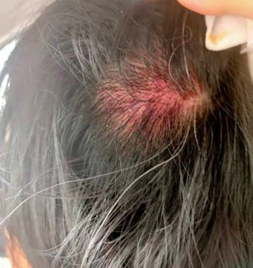 M'sian woman beaten up over RM12 nasi lemak
