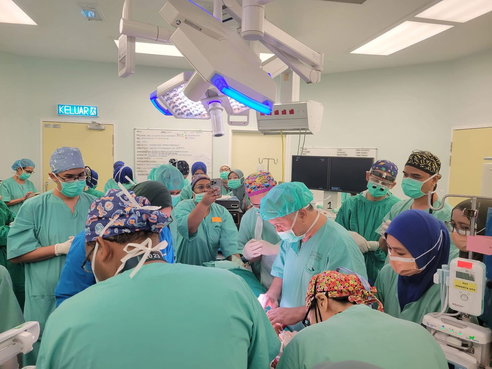 HTA 3Mo Conjoined Twins 1