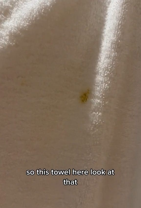 poop stains on towel