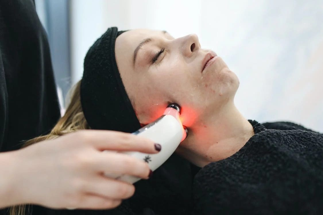 M'sian Woman Claims Face Was Severely Damaged By Laser Treatment, Beauty Clinic Denies Allegations