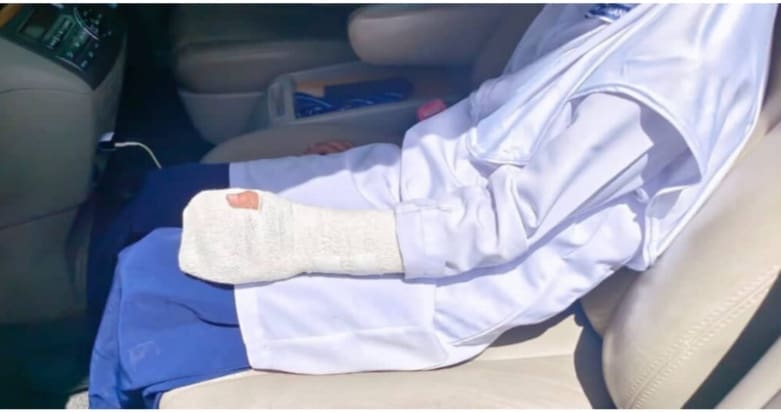 8yo Student Fractures Her Finger After Ceiling Fan Fell On Her During Class