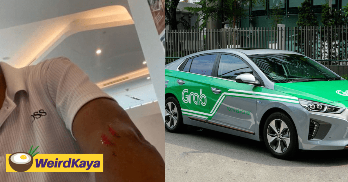 Woman Allegedly Leaves Bloodied Scratch On Grab Driver's Arm For Making Her Late