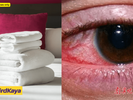 China Man Contracts Gonorrhoea After Using Hotel Towel To Wipe His Face During A Business Trip