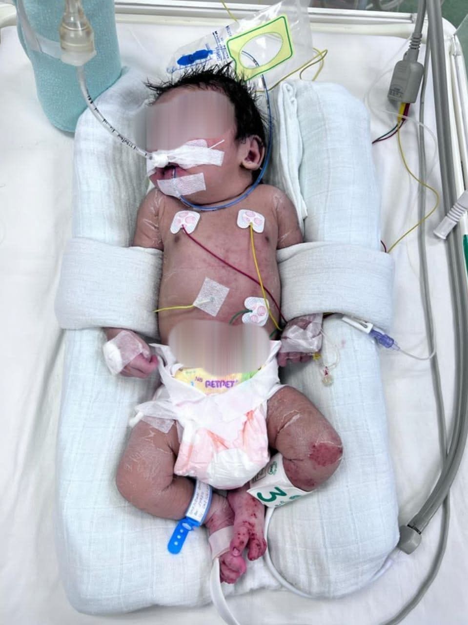 Newborn Baby Abandoned At Ipoh Bus Stop, Entire Body Covered With Ants 2