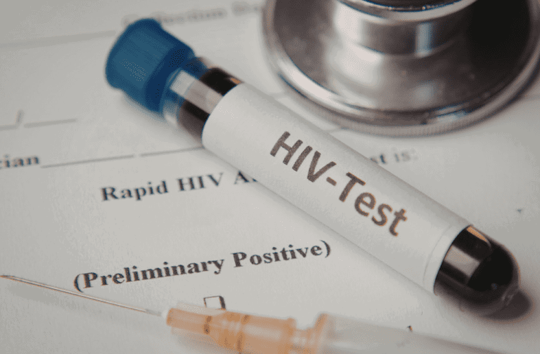 positive HIV test