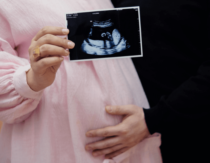 pregnant woman