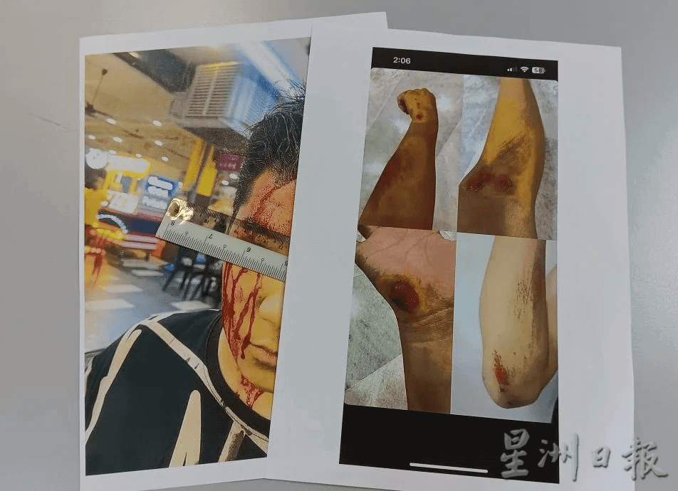 Teens injured by Gang 24 members