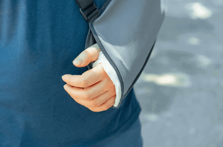 Woman's arm bandaged up