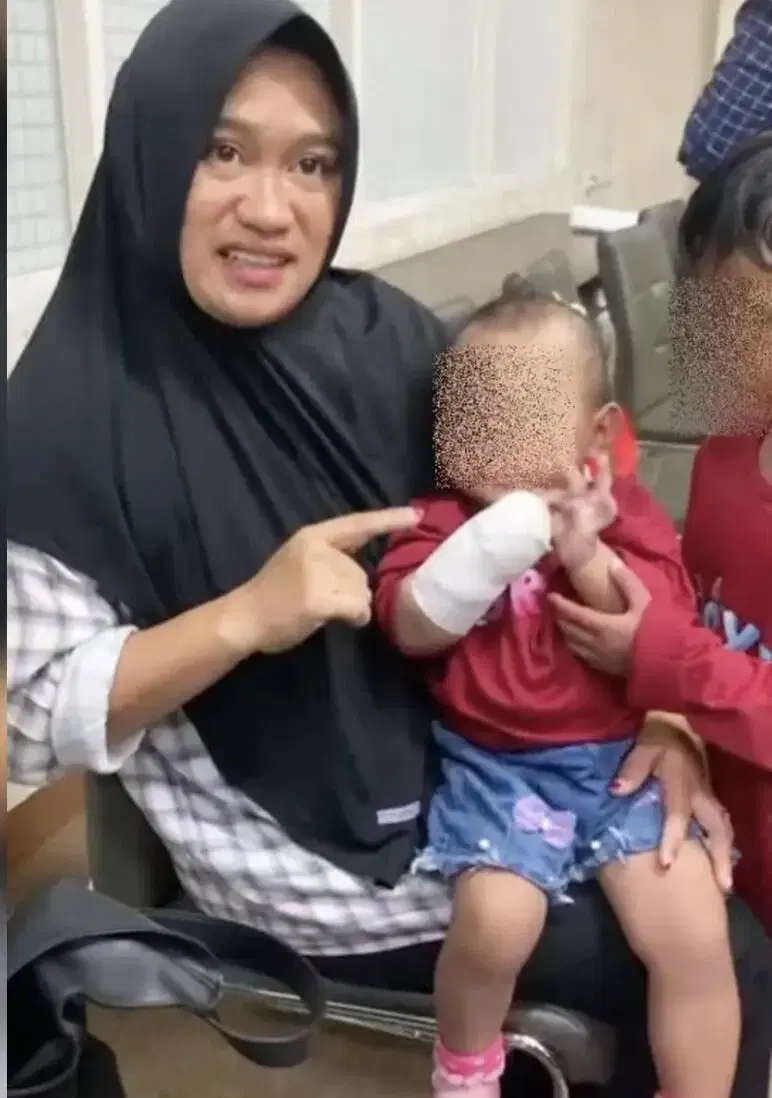 1yo Indonesian Girl Has Her Hand Amputated After Swelling Was Repeatedly Ignored for 3 Days
