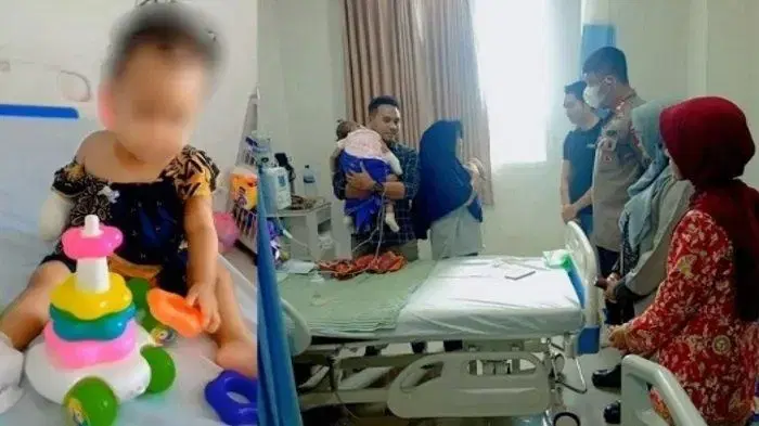 1yo Indonesian Girl Has Her Hand Amputated After Swelling Was Repeatedly Ignored for 3 Days