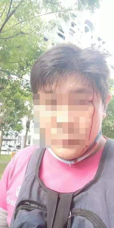 Delivery rider gets struck by a metal rod, receives 9 stitches to his face