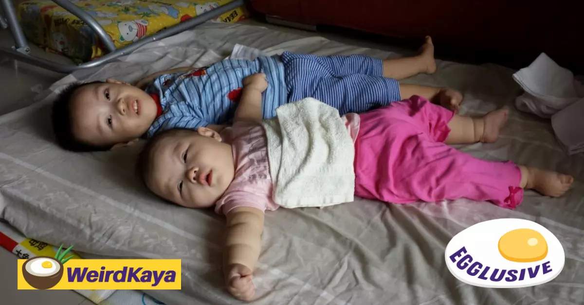 “giving up isn’t an option” read how ng’s children overcame a rare genetic disorder | weirdkaya