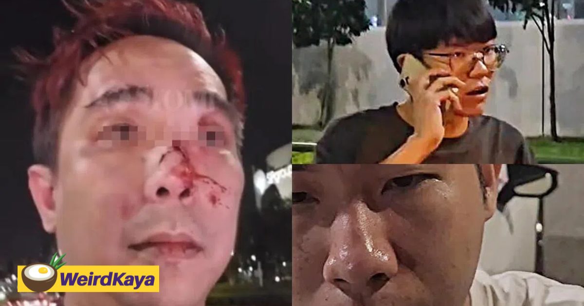 SG E-Hailing Driver Has Nose Broken After Telling 2 Passengers To Stop Fighting In Car | WeirdKaya