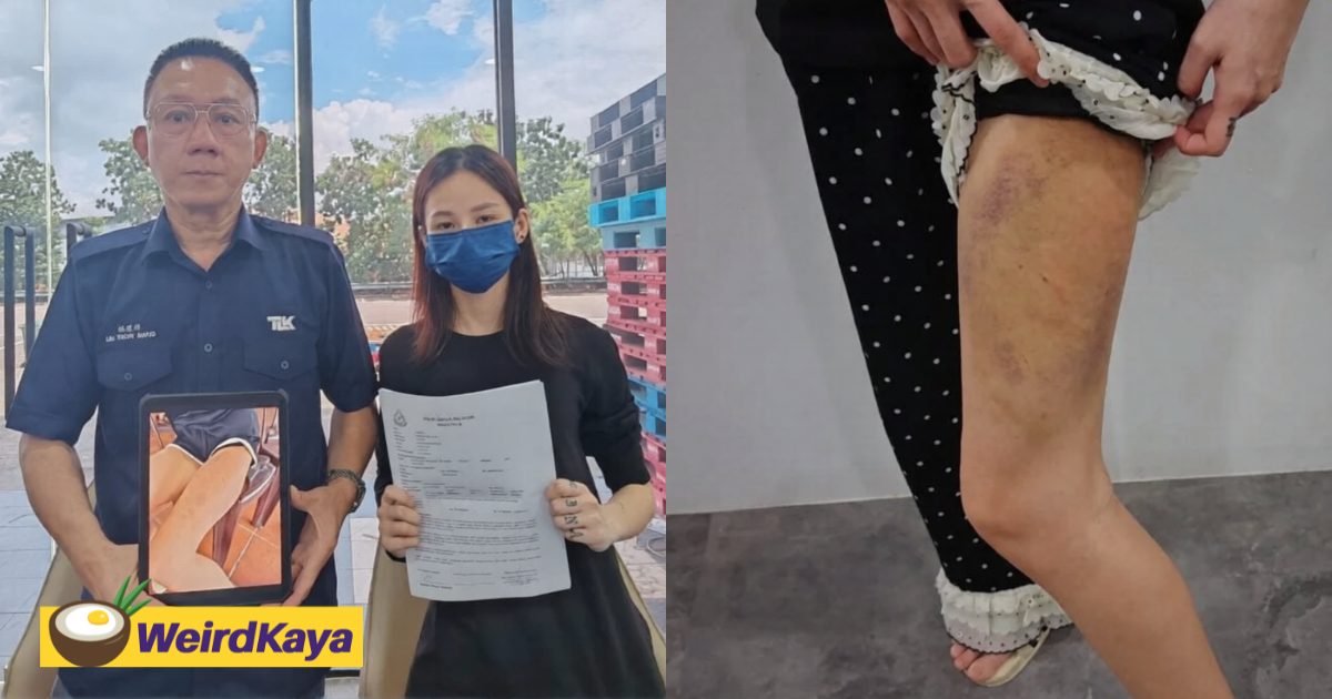 M’sian Woman Beaten By BF Of 6 Months For Still Being In Contact With Her Ex | WeirdKaya