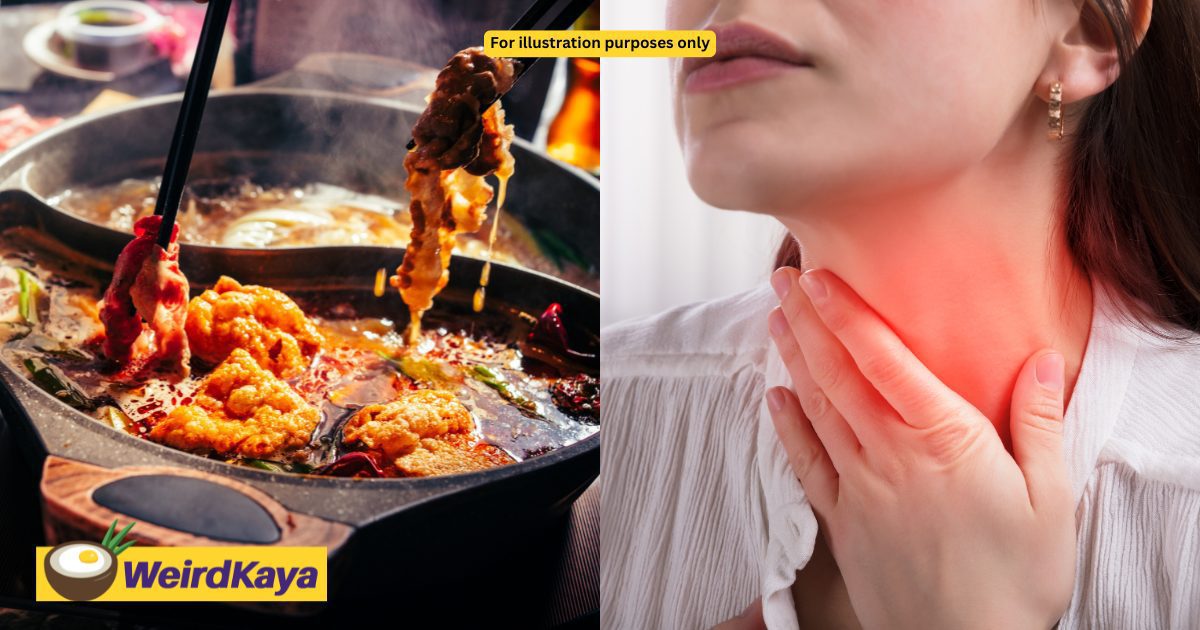 Woman In China Suffers 8cm Throat Ulcer From Eating Hot Pot Too Quickly | WeirdKaya