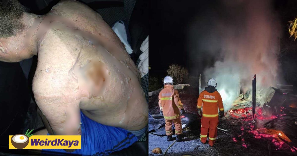 M’sian Man Suffers Burns After Failing To Save 16yo OKU Sibling From House Fire | WeirdKaya
