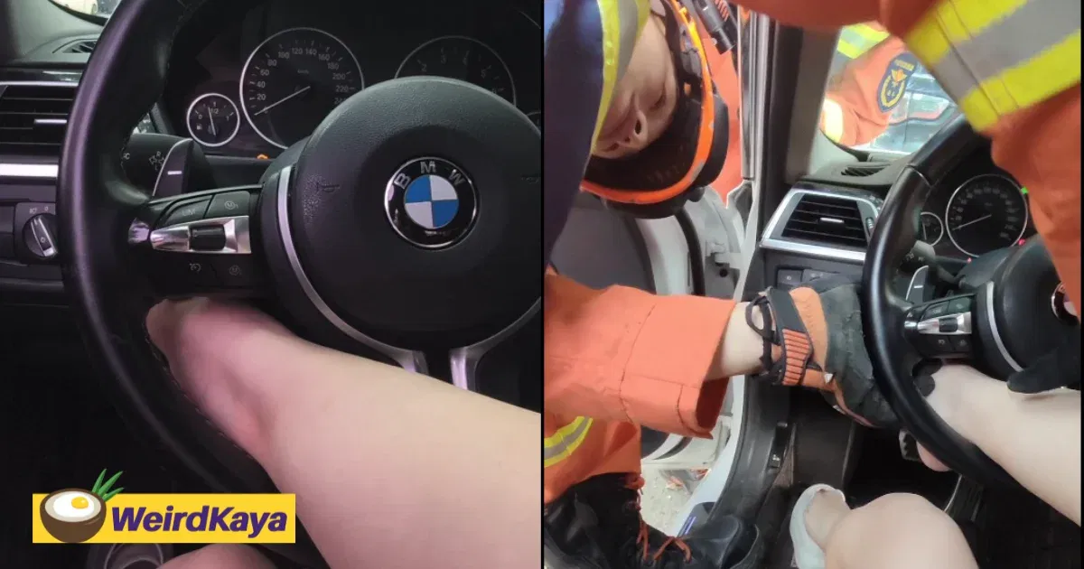 Woman Gets Foot Stuck Within Steering Wheel For 2 Hours, Calls Firefighters For Help | WeirdKaya