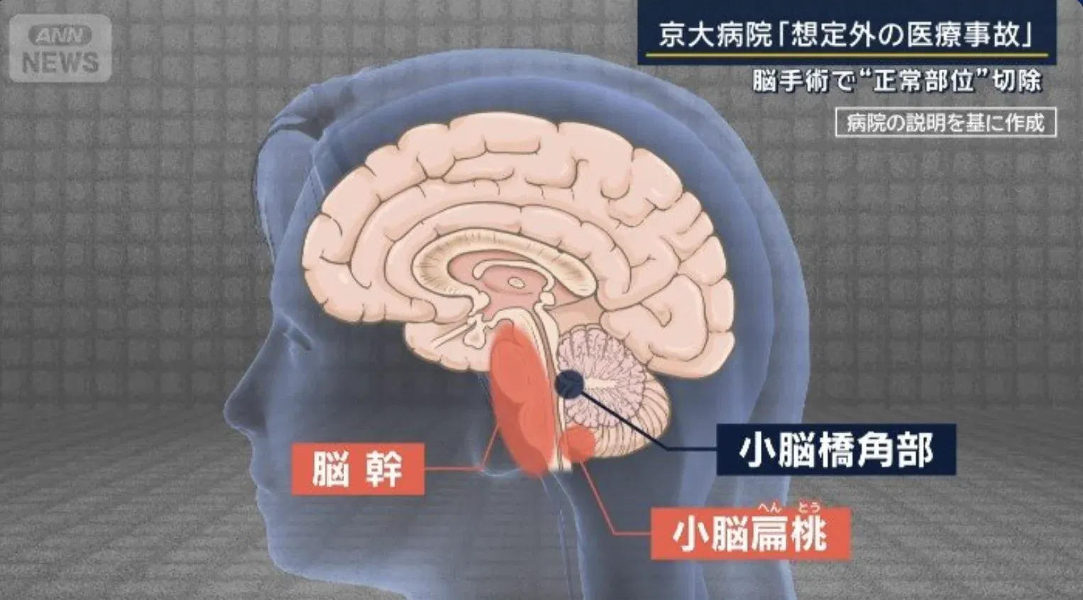  wk healthy brain tissue removed 