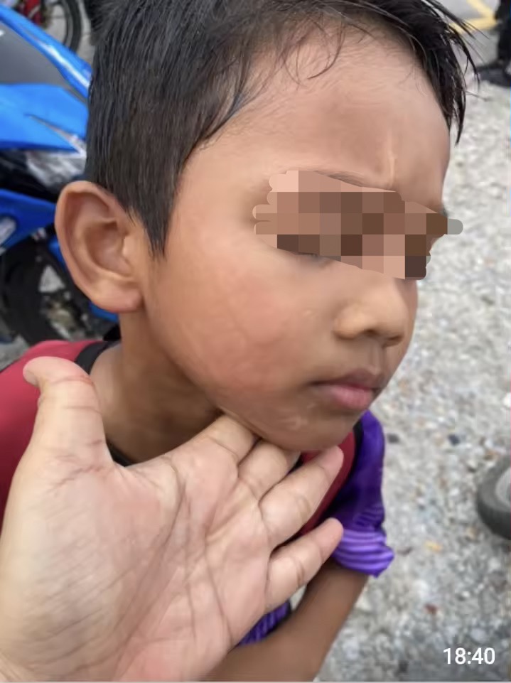 8yo m'sian boy slapped by teacher