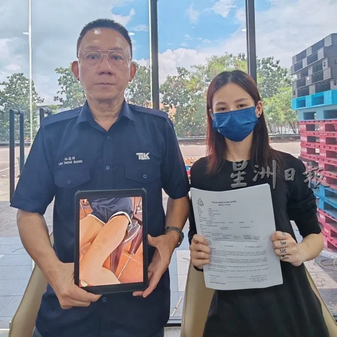 Single mum beaten by BF (1)