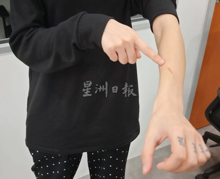 Single mum beaten by BF (4)