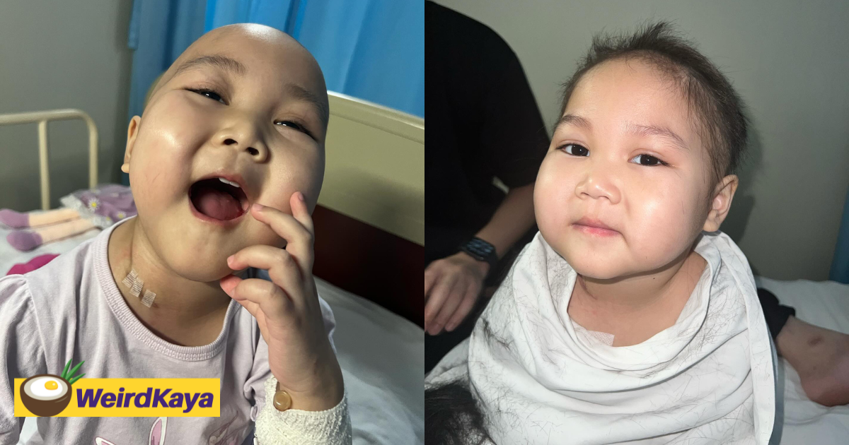 'being bald is cute, right? ' — 4yo m'sian girl's courage in battling leukemia touches netizens' heart  | weirdkaya