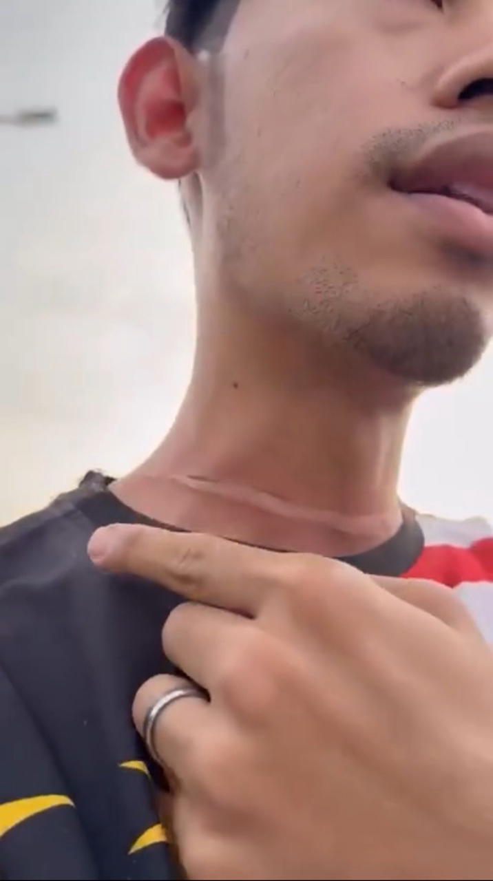 biker strangled kite string slashes neck wound