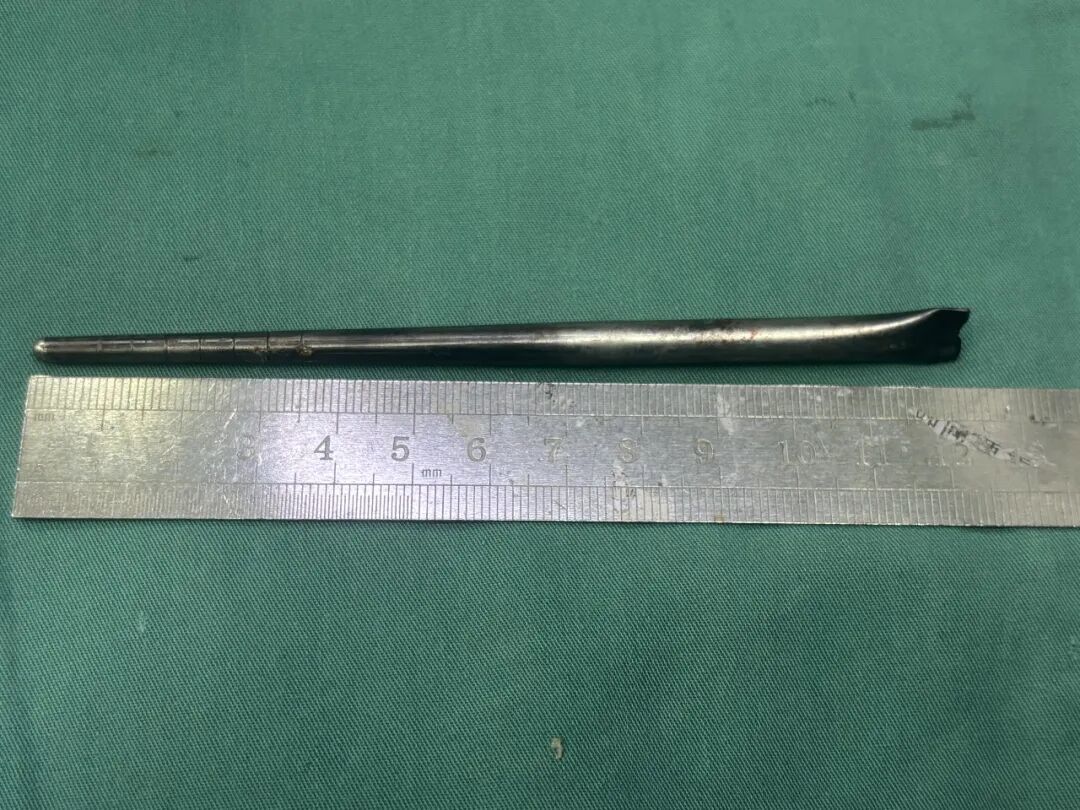 Chopstick inside throat (2)