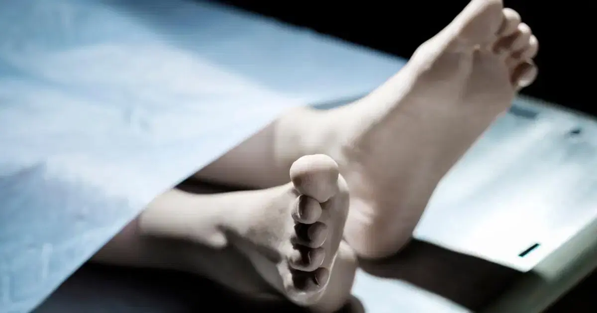 death body