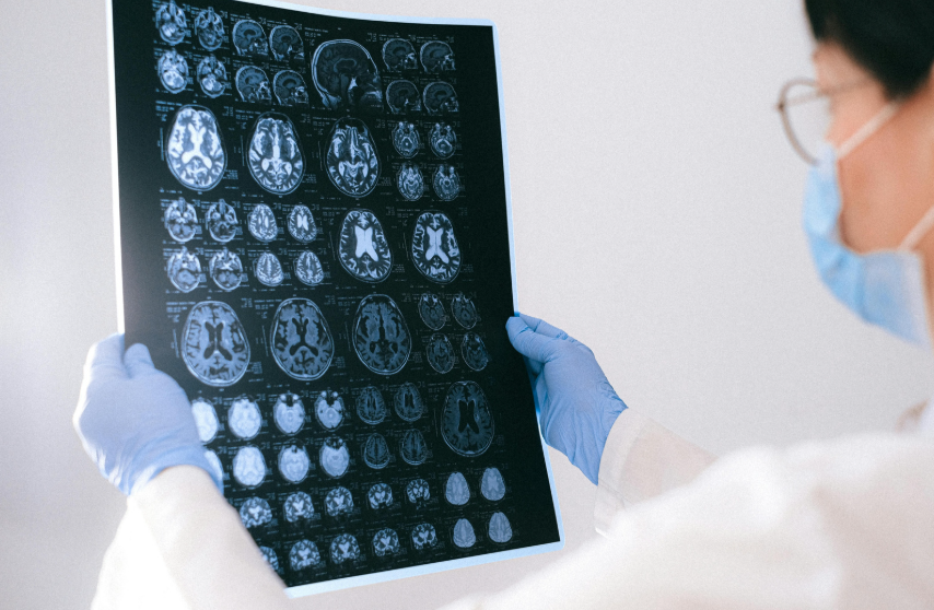 Image from: Woman In China Suffers Brain Damage After Drinking Only Water For Half A Month To Lose Weight | WeirdKaya