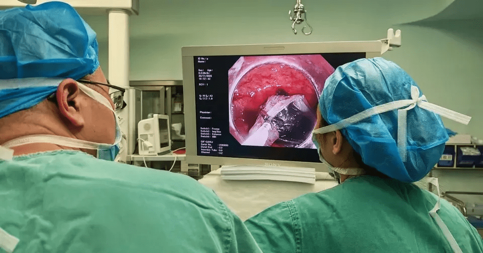 Doctors working to remove lighter from man's stomach