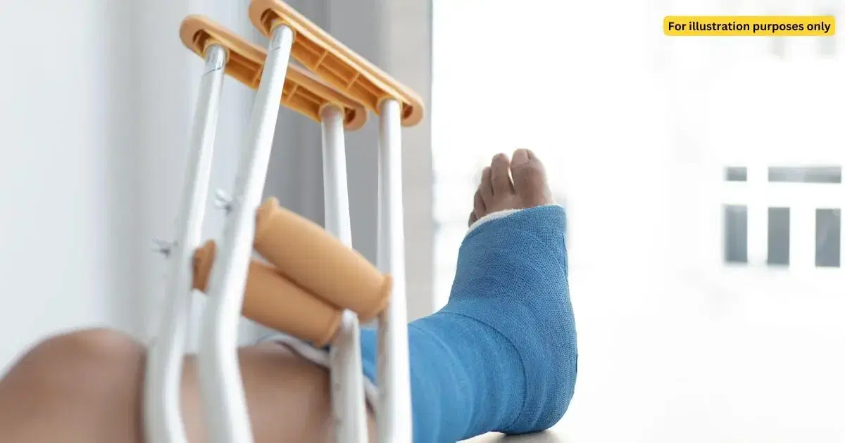 FRACTURED FOOT