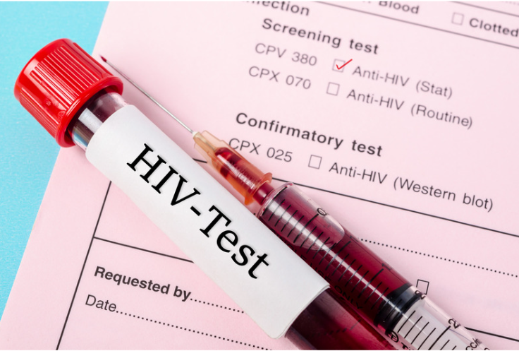 Hiv test