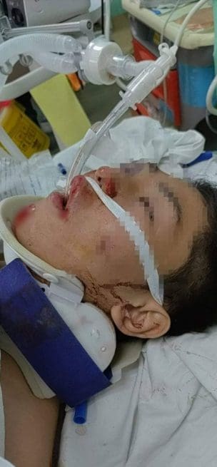 Cai Weijie in ICU
