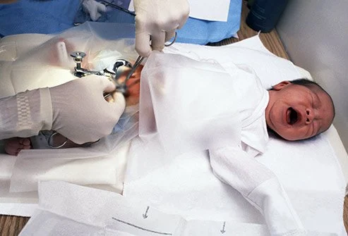 Doctor performing circumcision on baby