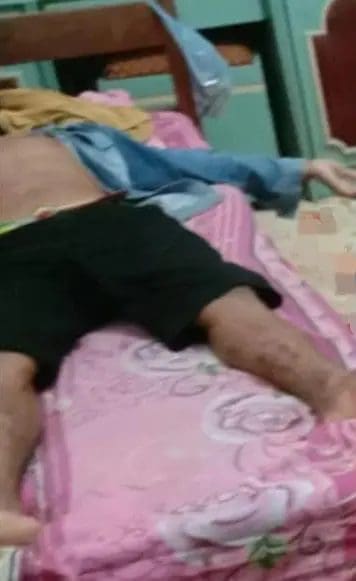 Man's Penis Cut Off By GF After He Threatened To Leak Sex Tape