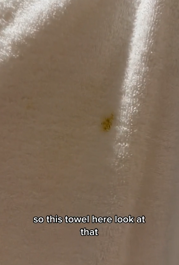 Poop stains on towel