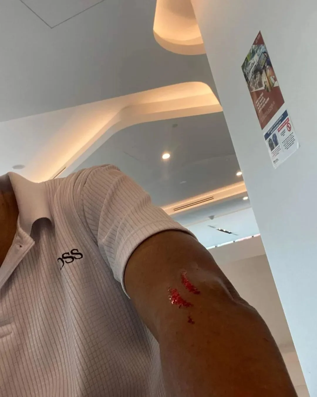 Woman allegedly leaves bloodied scratch on grab driver's arm for making her late