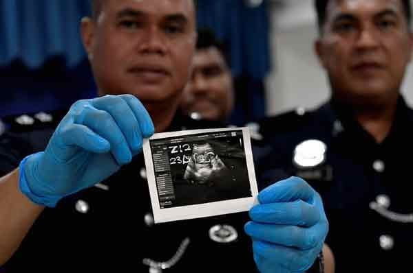 M'sian Woman Whose Charred Body Was Abandoned At Palm Oil Plantation Stabbed By Boyfriend Over Pregnancy