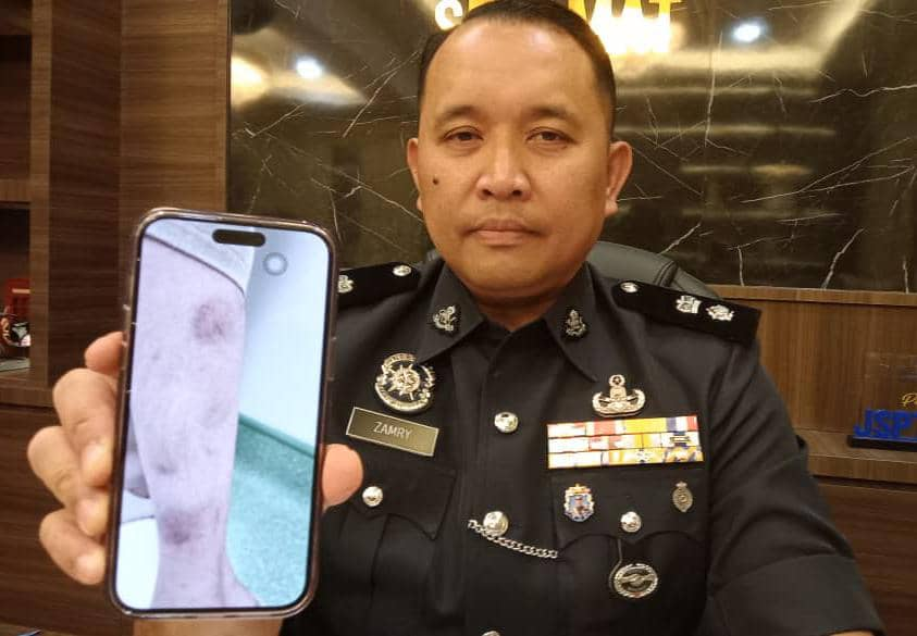 M'sian man canes 20yo daughter more than 10 times for working as salesperson behind his back