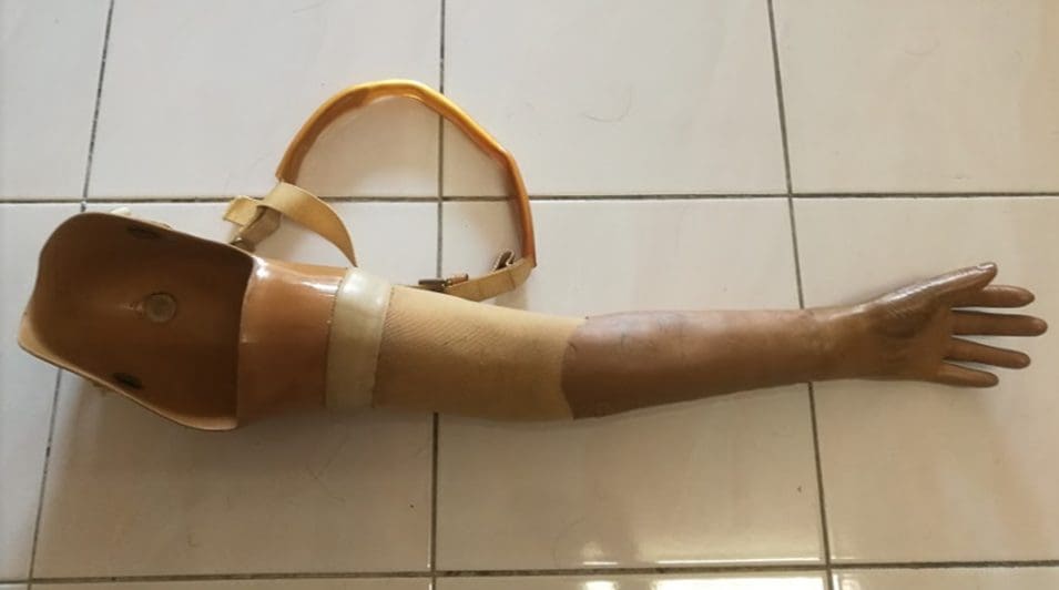 CK Loh's prosthetic limbs