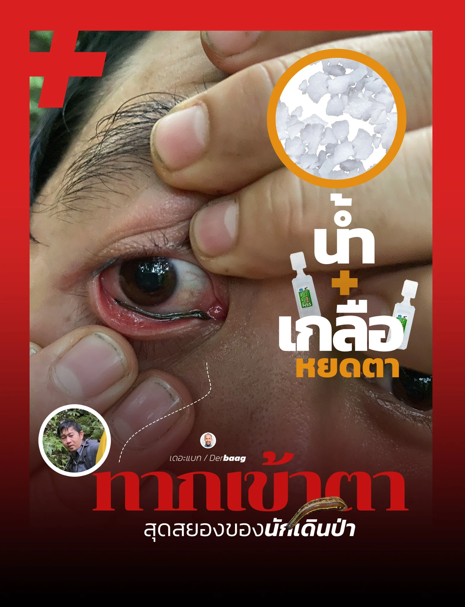Leech crawls into man's eye in thailand