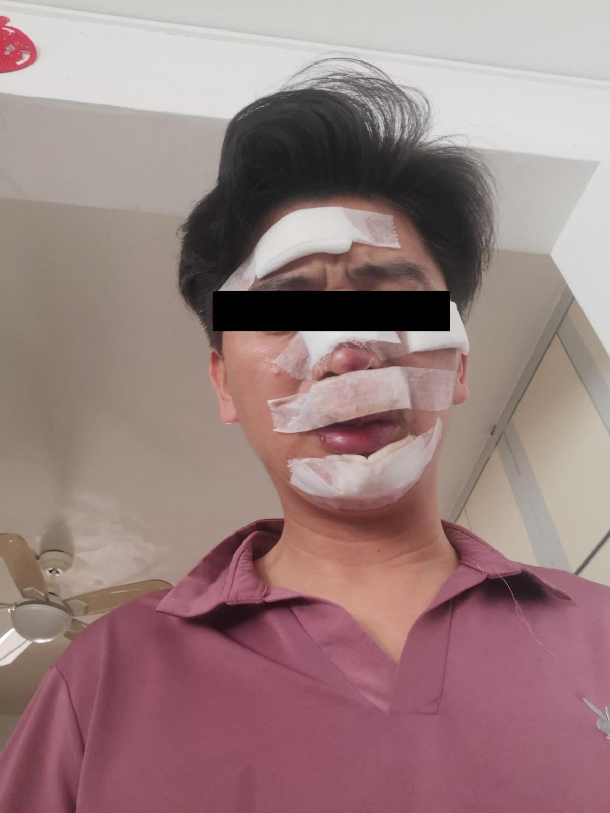 Lin loses teeth and suffer facial injuries while rescuing son from kidnappers